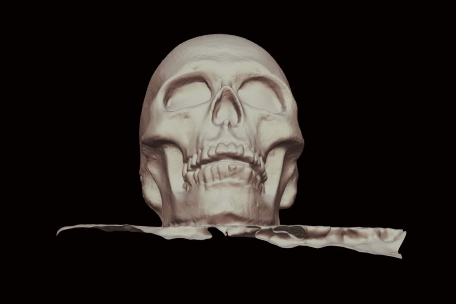 Skull
